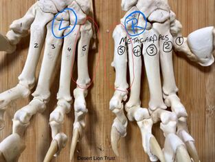 Images of the damage & remodelling of the right metacarpal No. 5, and with comparison to the left foot. 