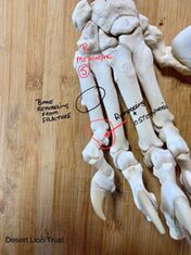 Images of the damage & remodelling of the right metacarpal No. 5, and with comparison to the left foot. 